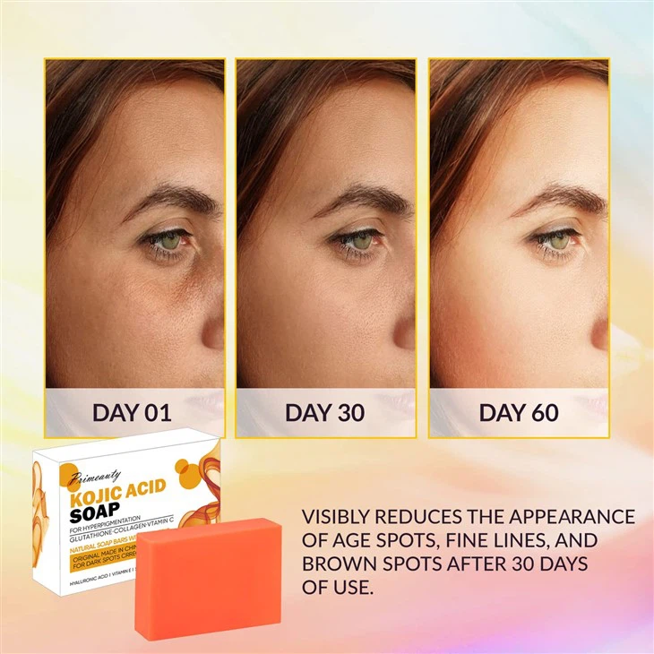 Kojic Acid And Vitamin C Soap